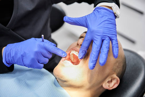 Best Knocked-Out Tooth Emergency  in Cypress Quarters, FL